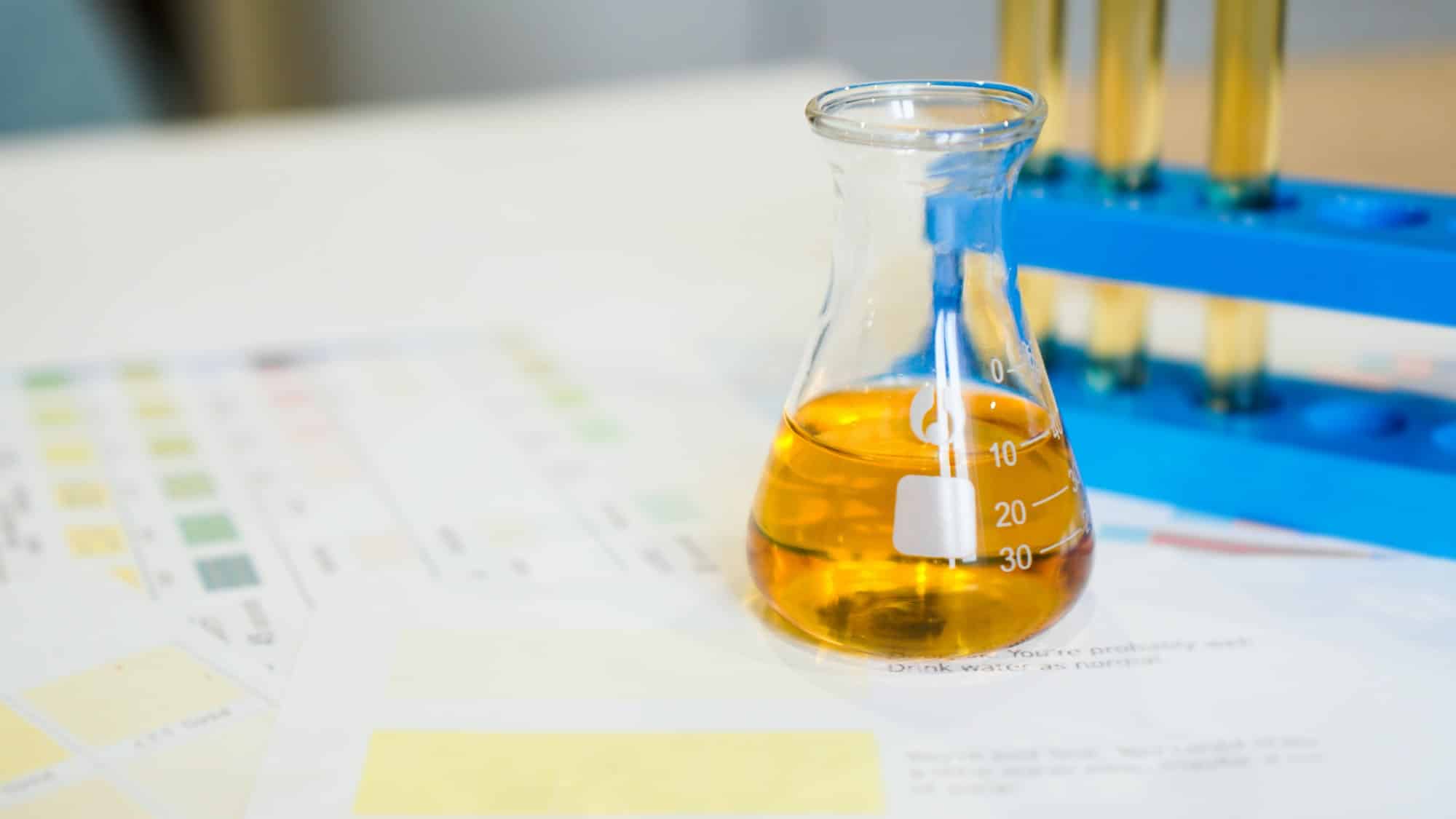 Flask and test tubes with urine on medical color schemes. Concept of analyzes