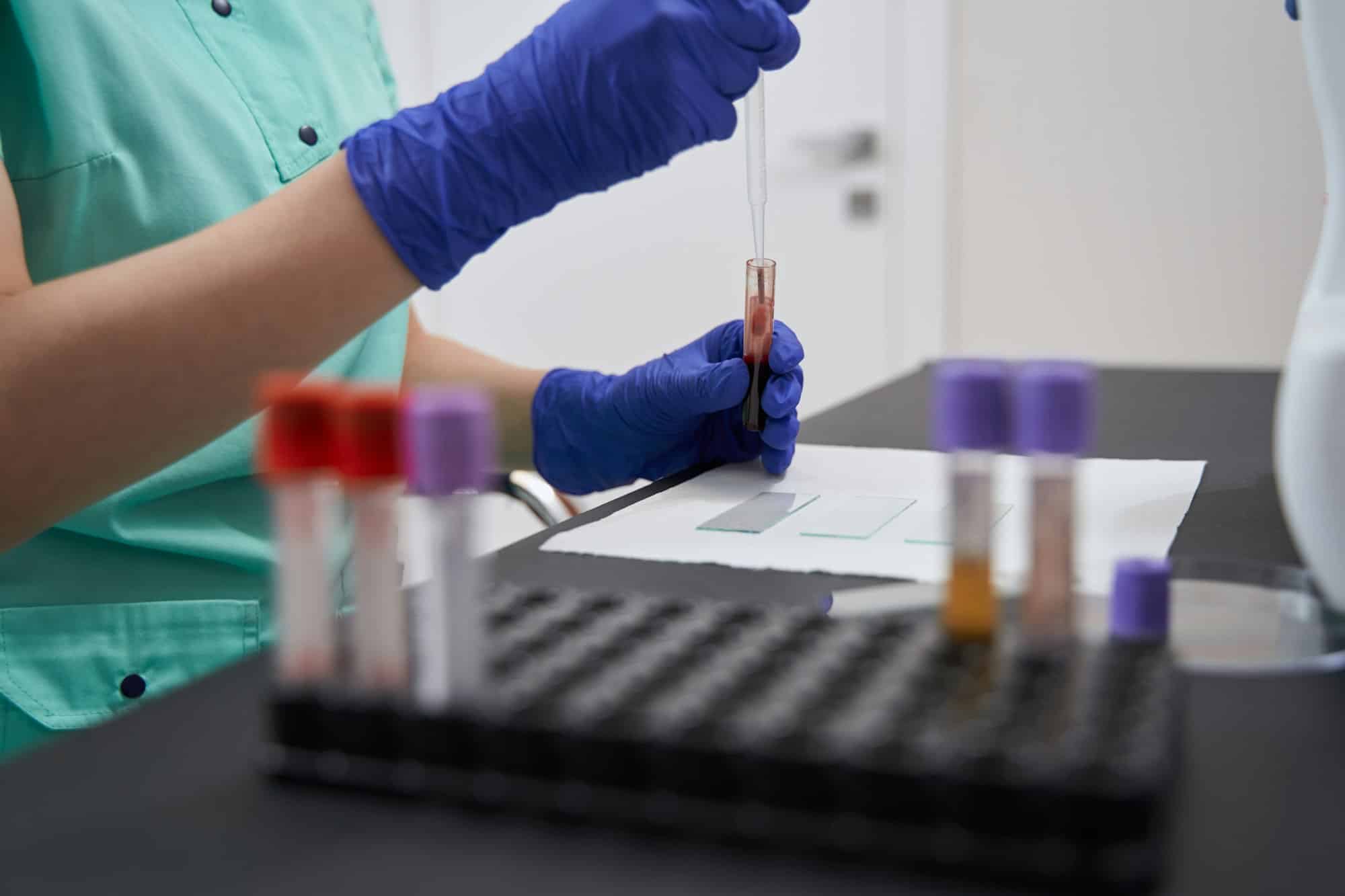 Medical worker making tests in the laboratory