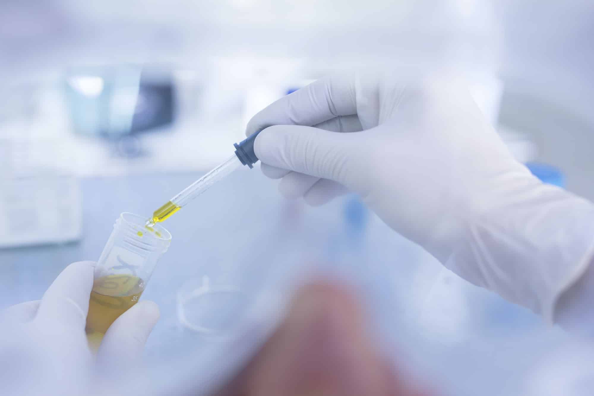 Laboratory worker taking liquid from test tube, using pipette, close-up